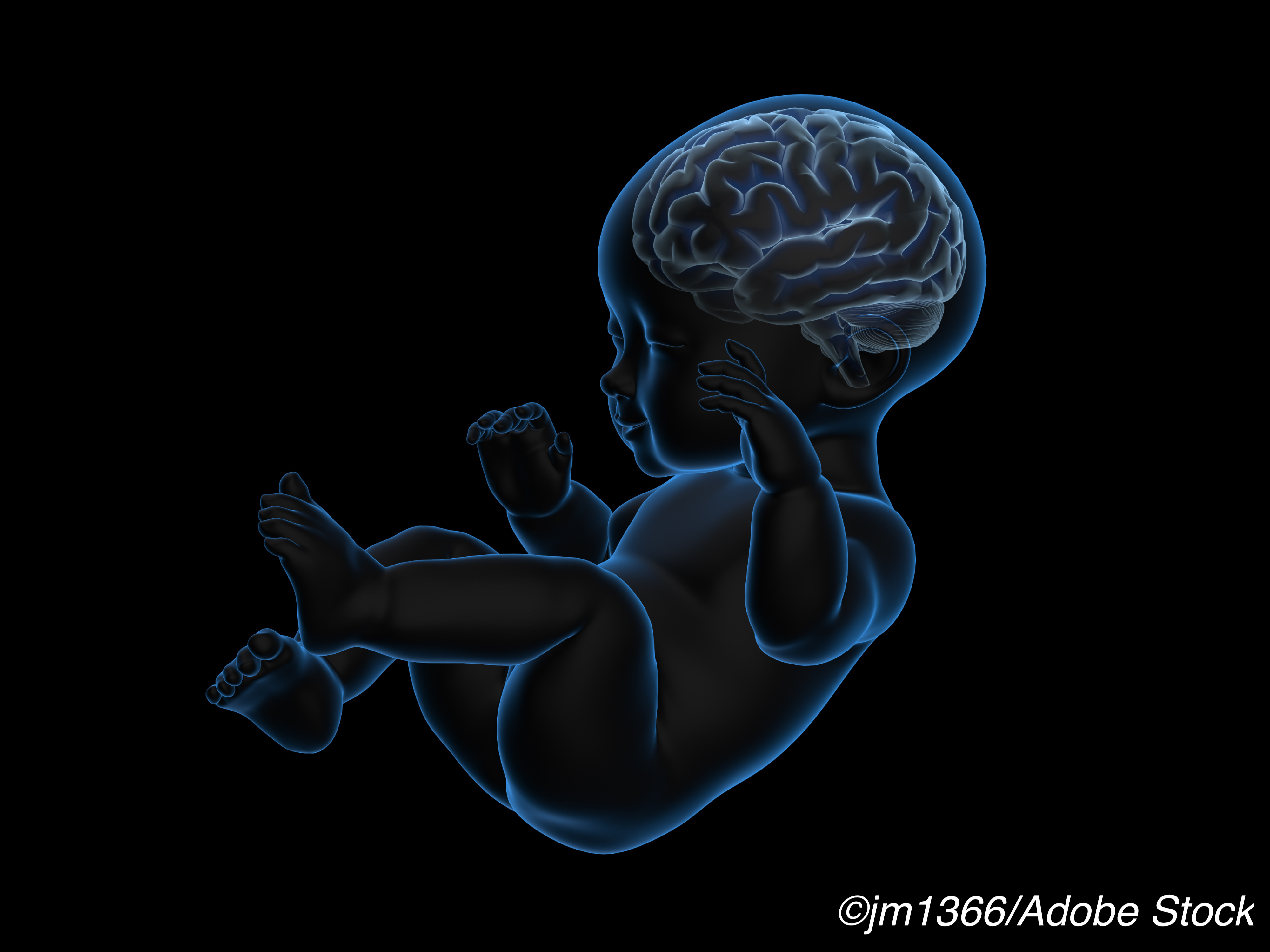 Infants with Zika with Normal Head Circumference Show Neurologic Abnormalities