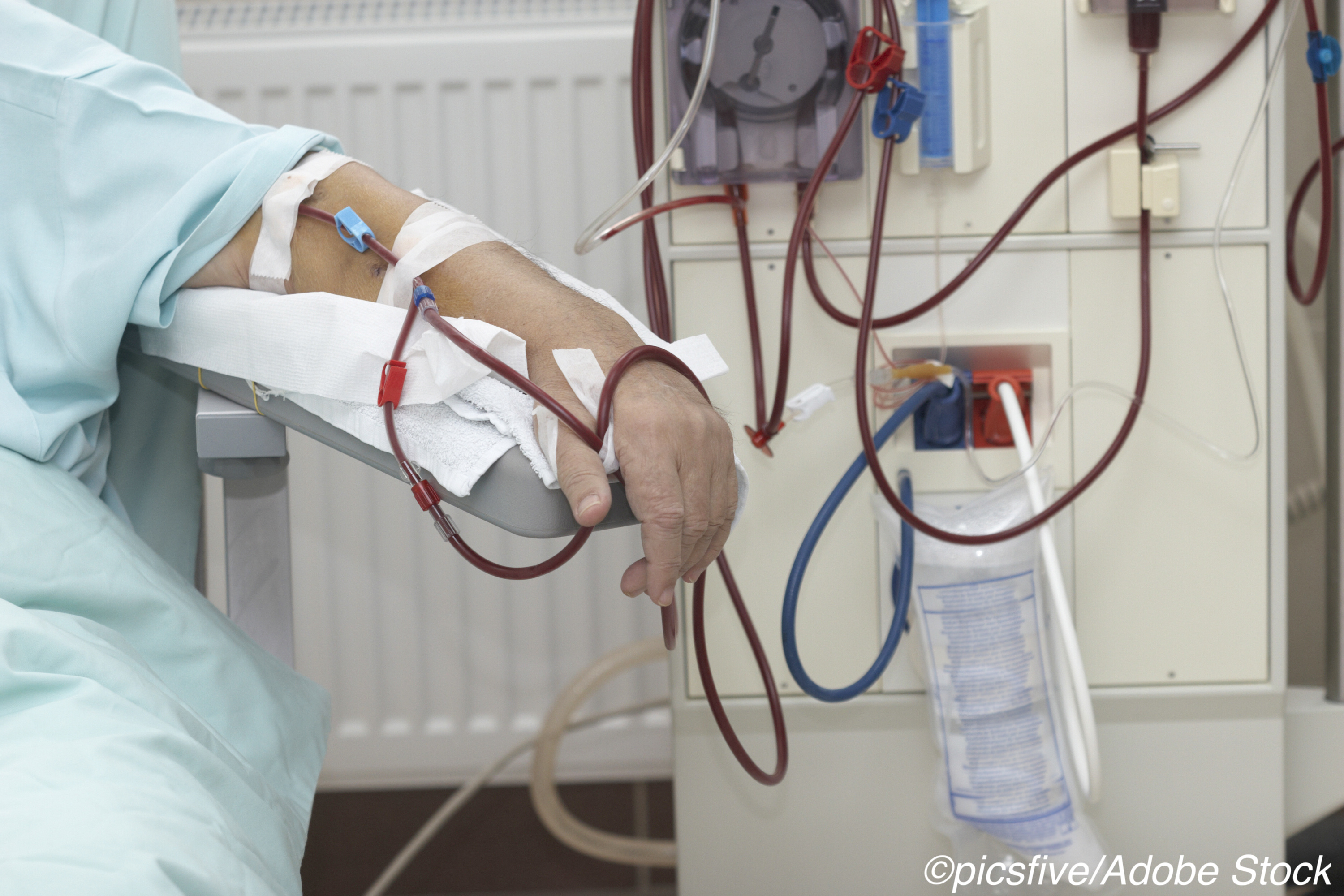 CMS Moves to Improve Access to At-Home Dialysis Options