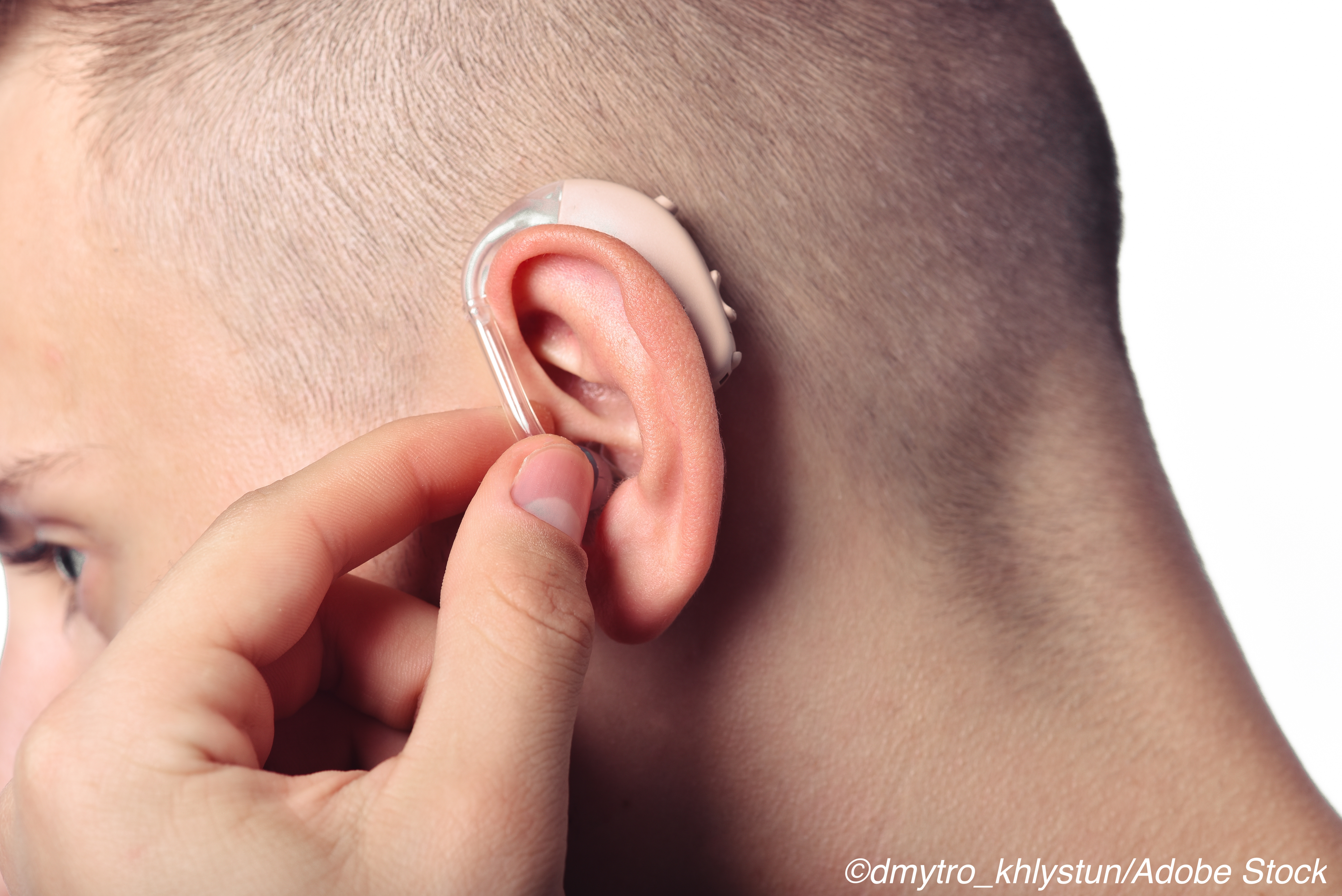 Hearing Impairment Resulting from Childhood Ca TX Increases Risk for Neurocognitive Deficits