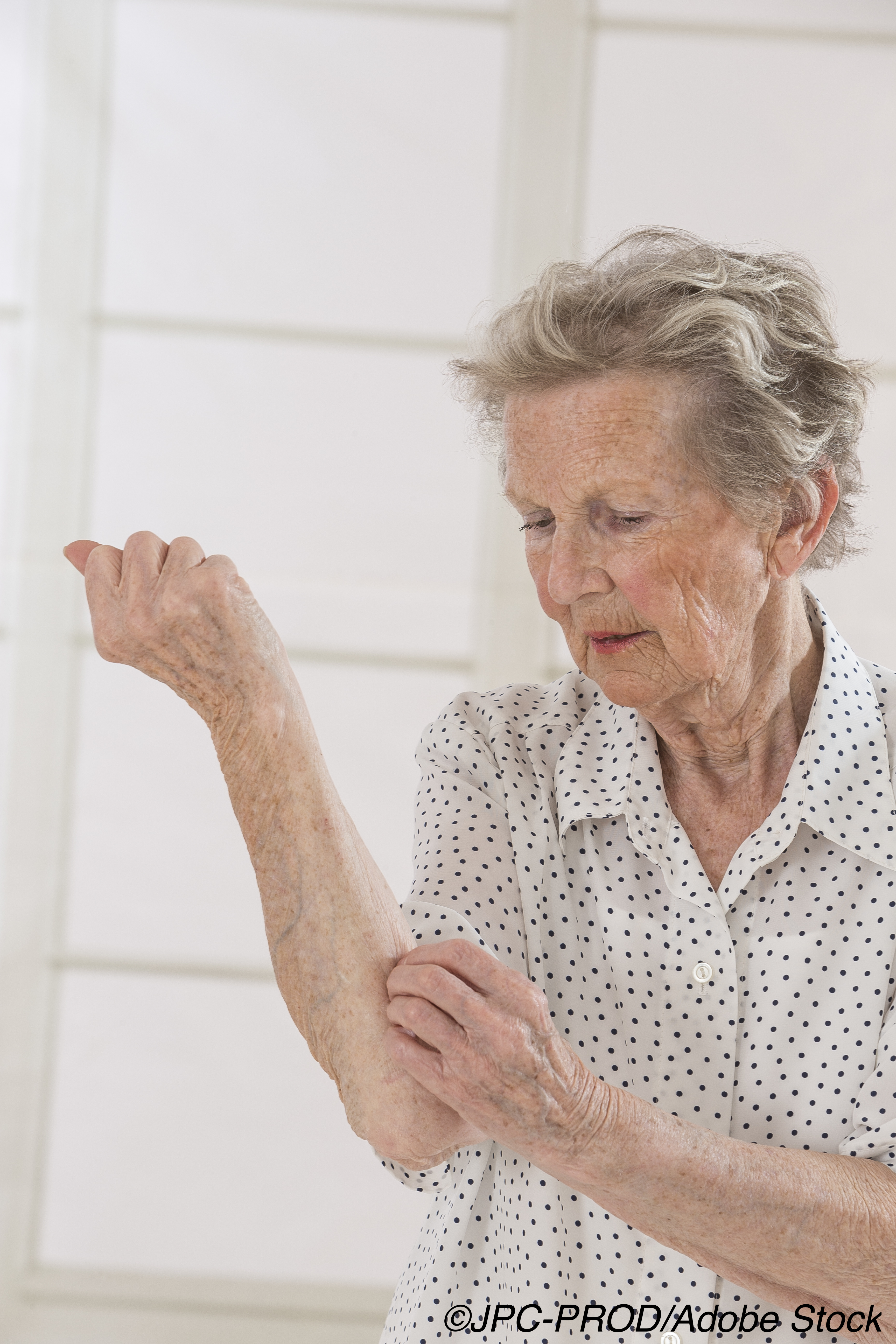 Excluding Elderly From Dermatology Trials Compromises Care