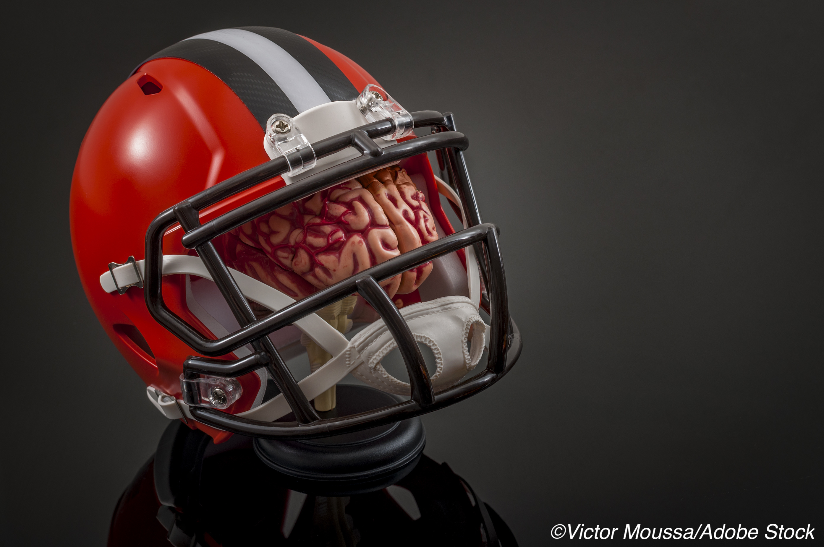Exposure to Football from Childhood Onward Not Related to Short-Term Concussion Recovery