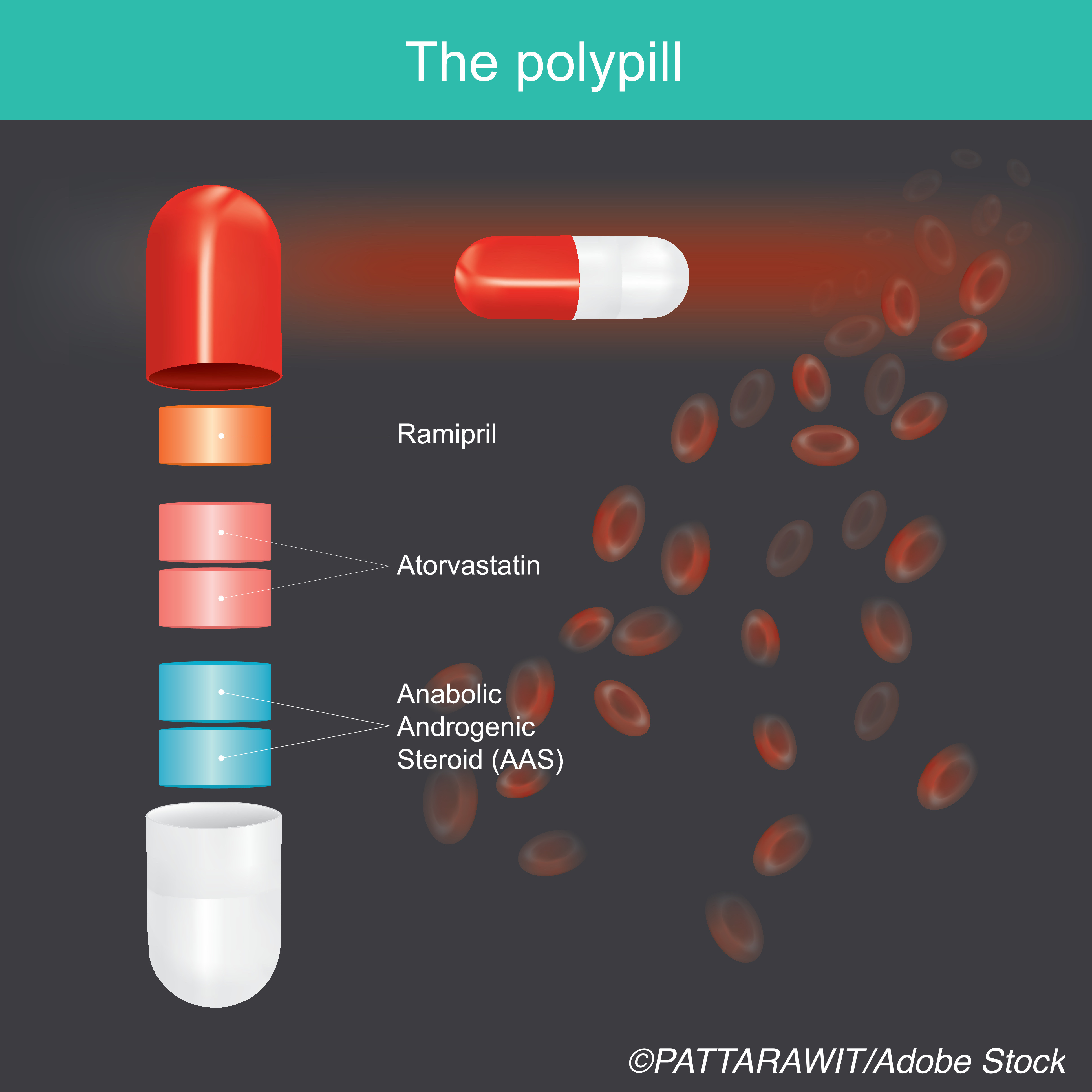 AHA: Polypill Plus Aspirin Improves Cardiovascular Outcomes