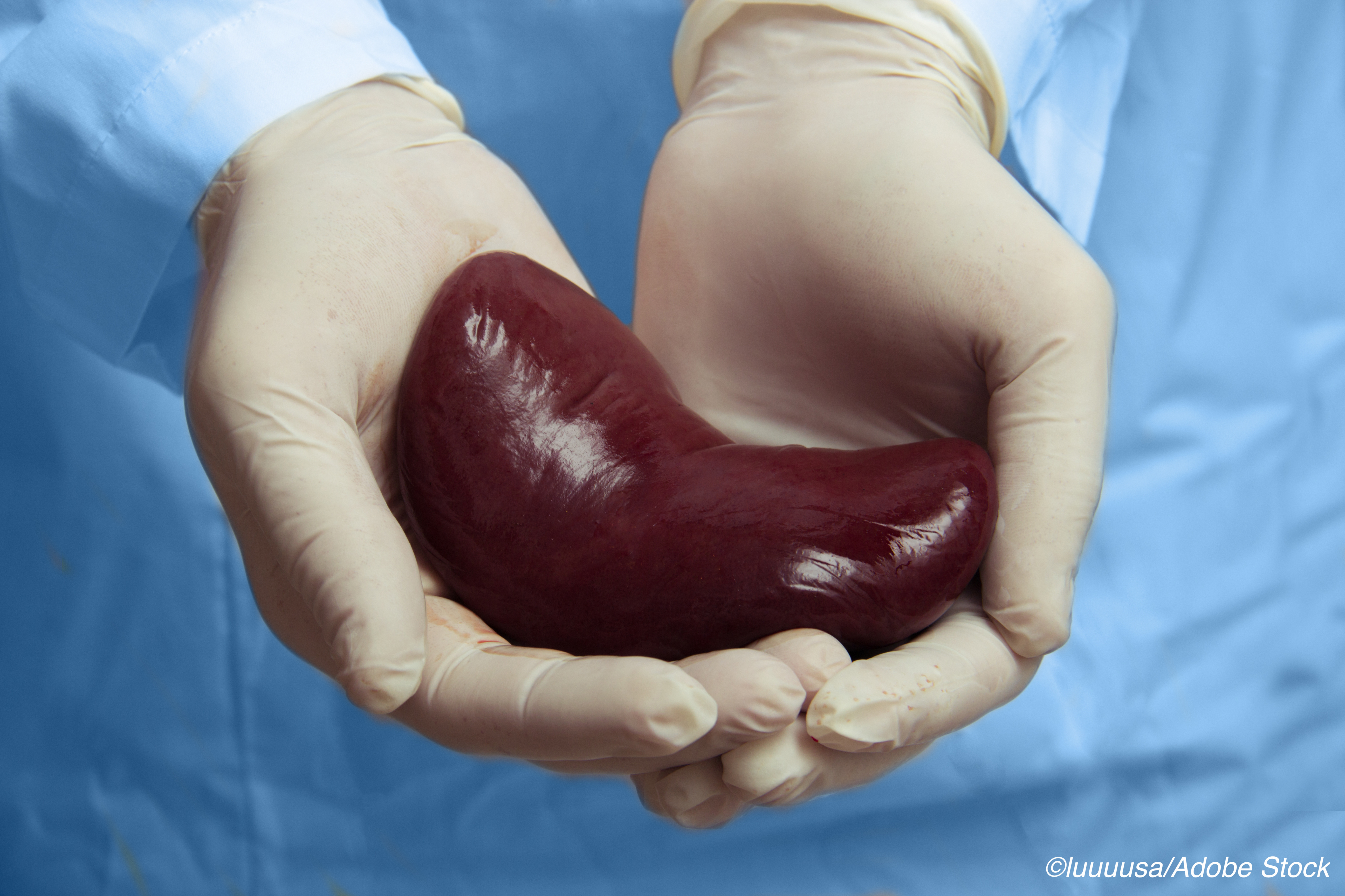 Oxygen Delivered During Donor Kidney Preservation is Easy, Safe, Adds Minimal Cost
