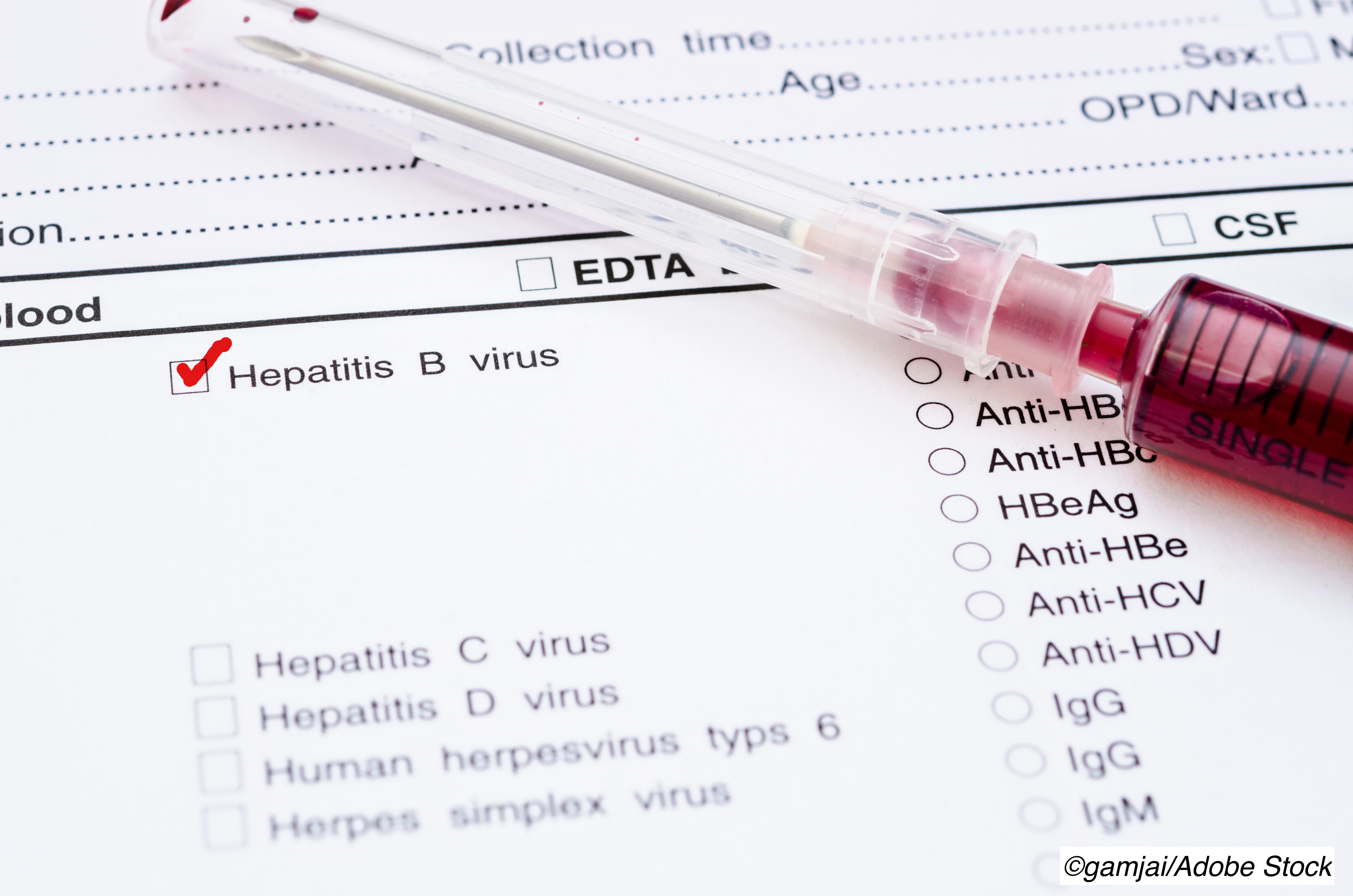 USPSTF: HBV Screen Beneficial Despite ’Moderate’ Evidence