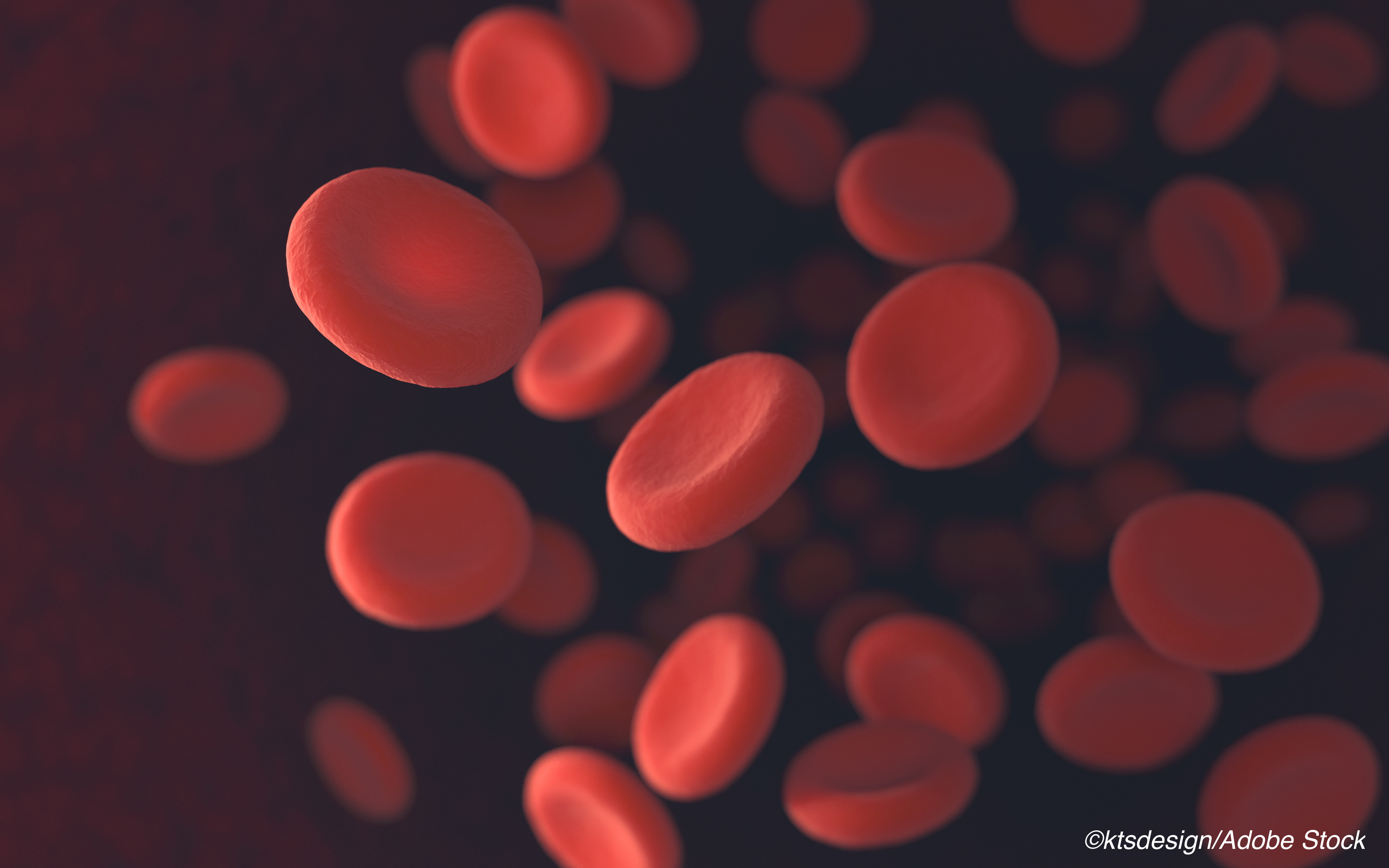 Hemoglobin Drop Post PCI May Increase Mortality Risk in ACS