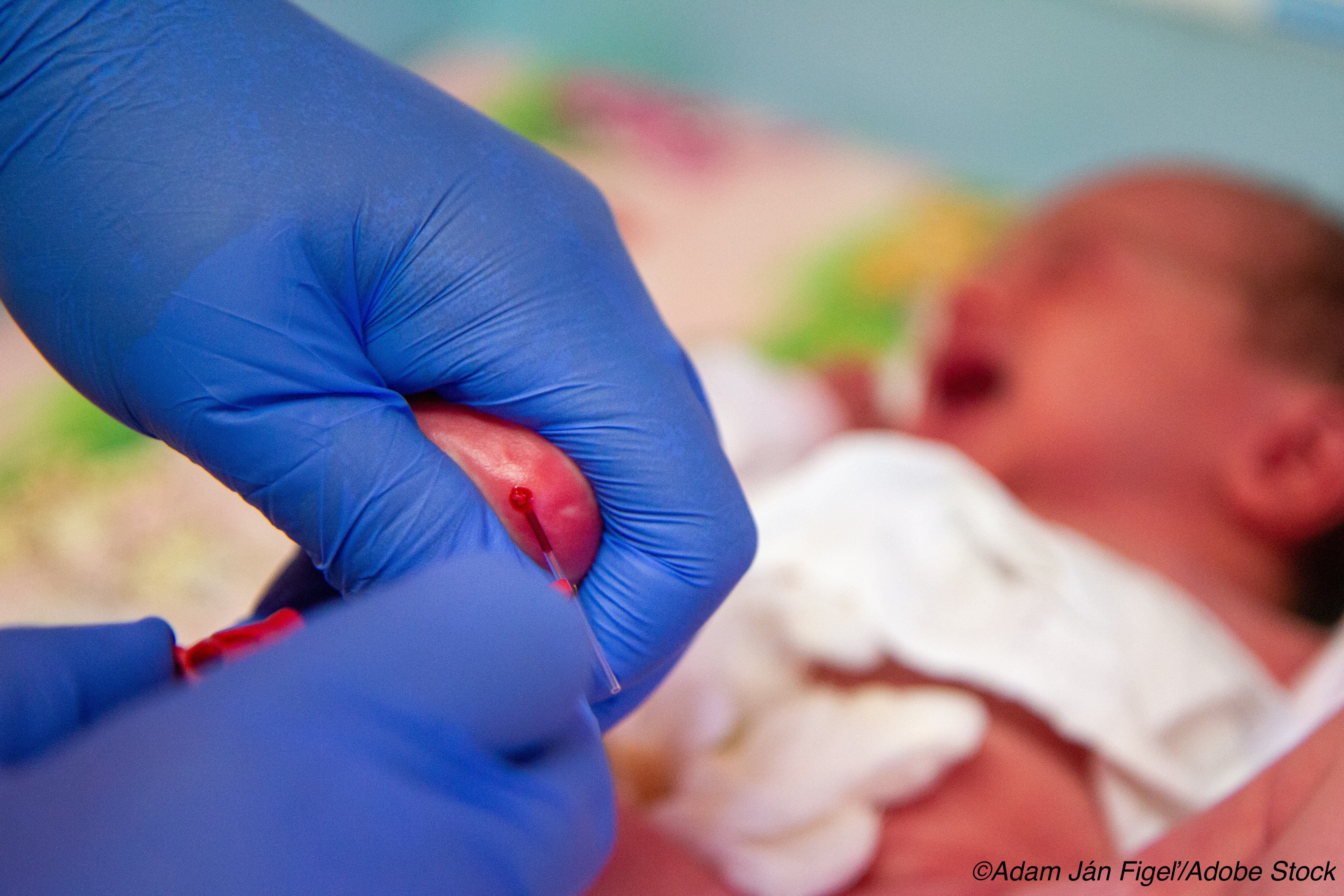 Dried Blood Spot Proves Mettle for CMV in Newborns