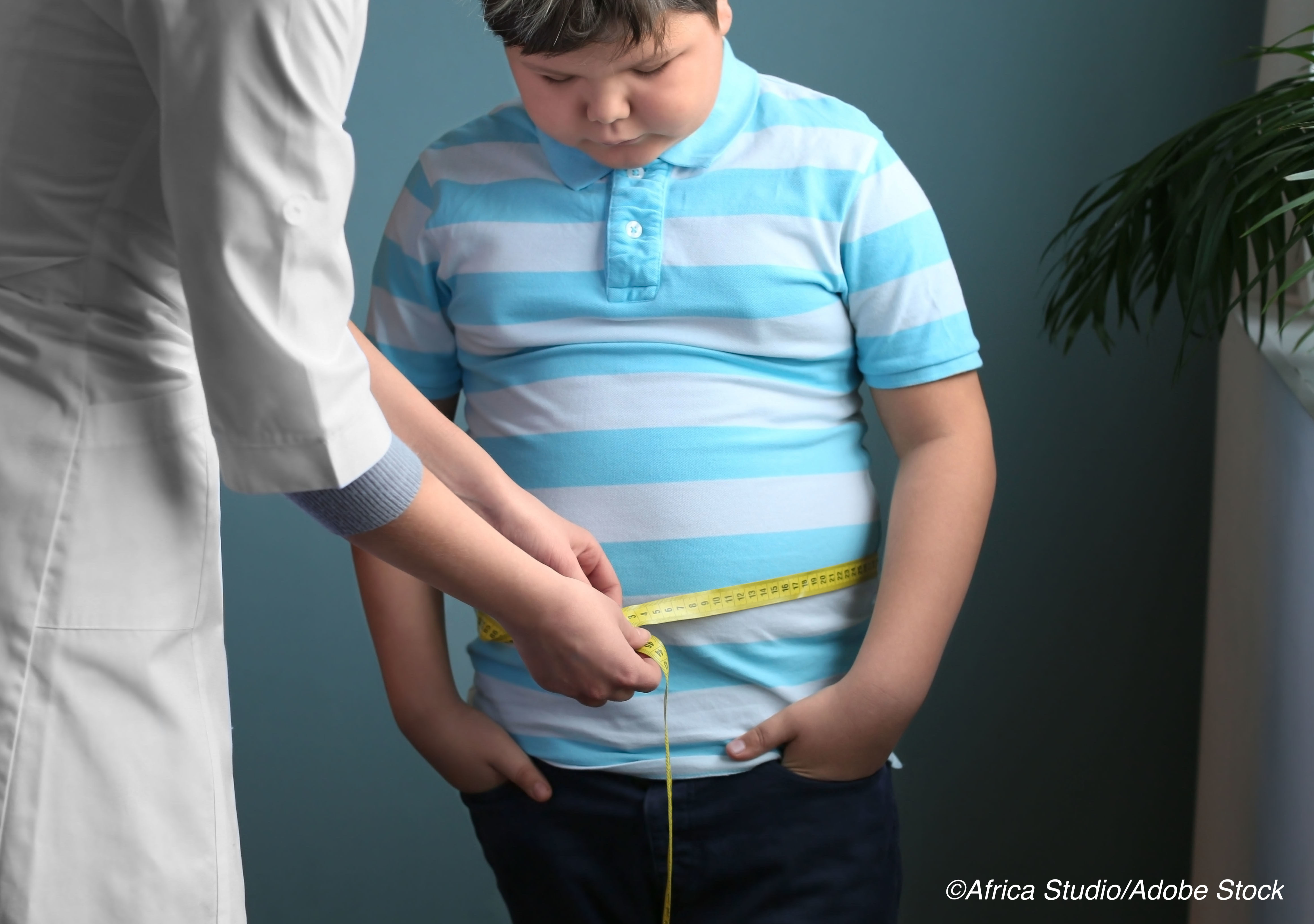 Лишний вес у подростка. Ожирение у подростков. Дети с избыточным весом. Лишний вес у подростков.