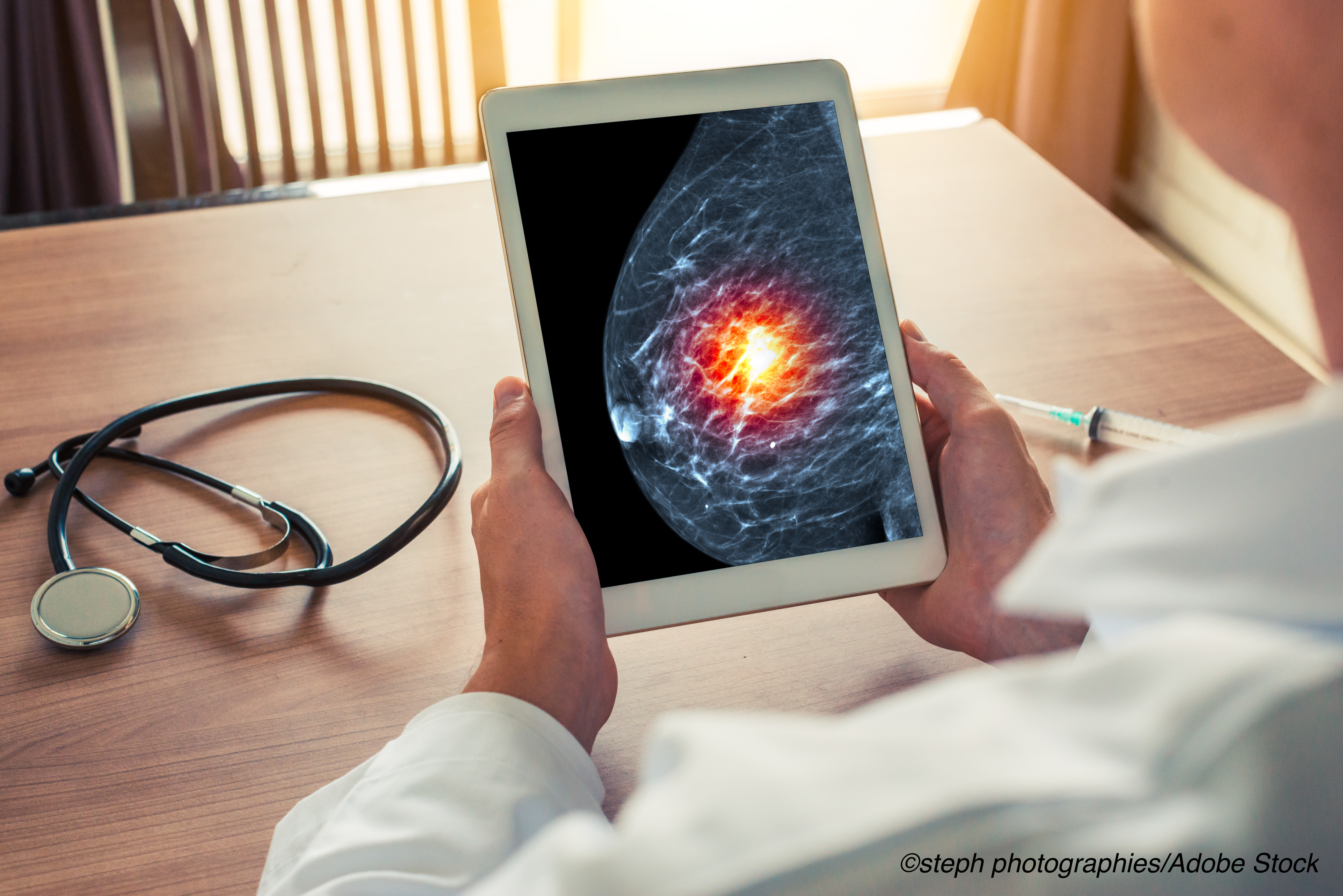 PD-1 Inhibitor Did Not Improve OS Compared to Chemo in Triple-Negative Breast Cancer