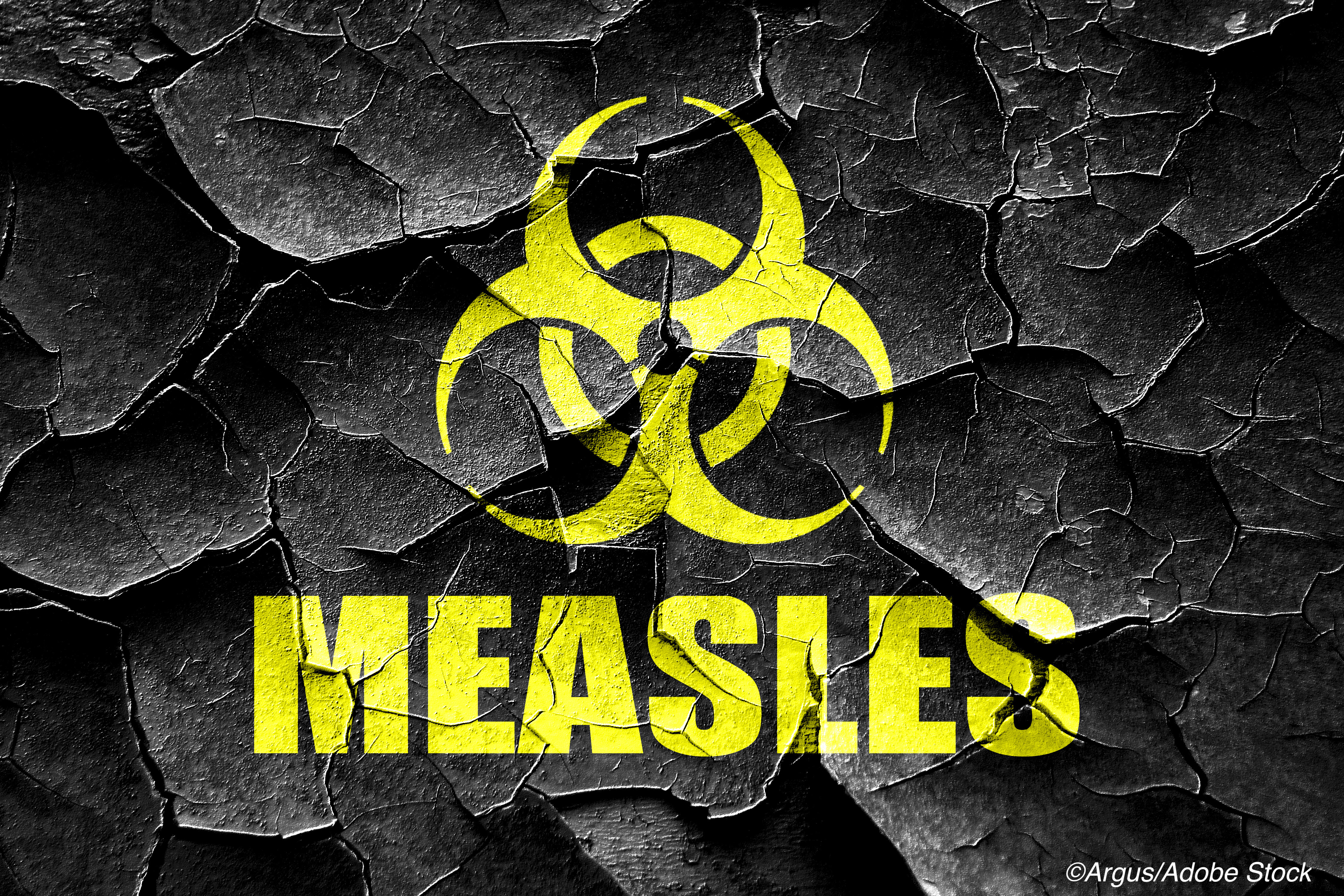 Measles: 2019 Single-County Outbreak Costs Millions