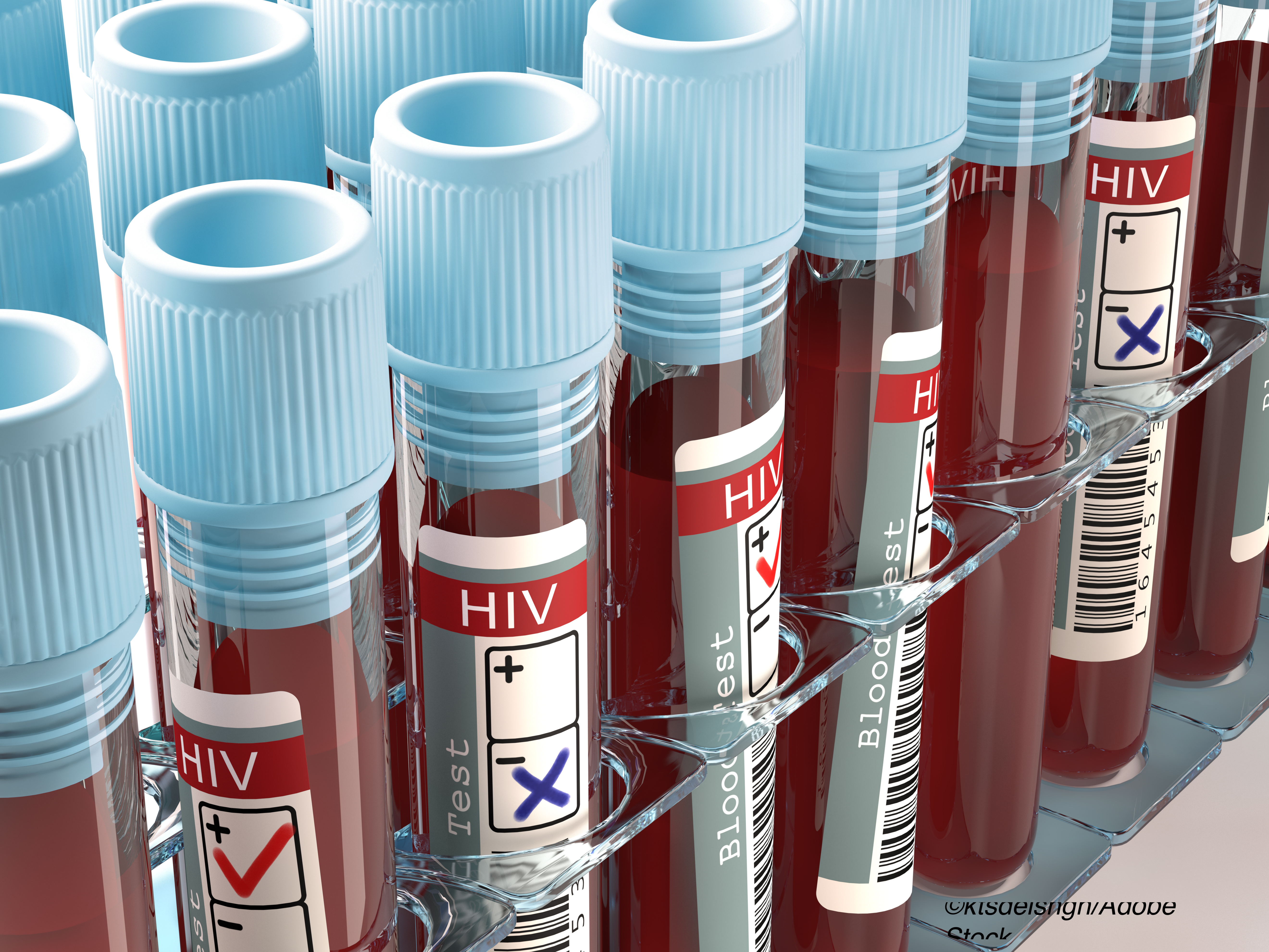 So-So Results with Neutralizing Antibodies to Foil HIV-1