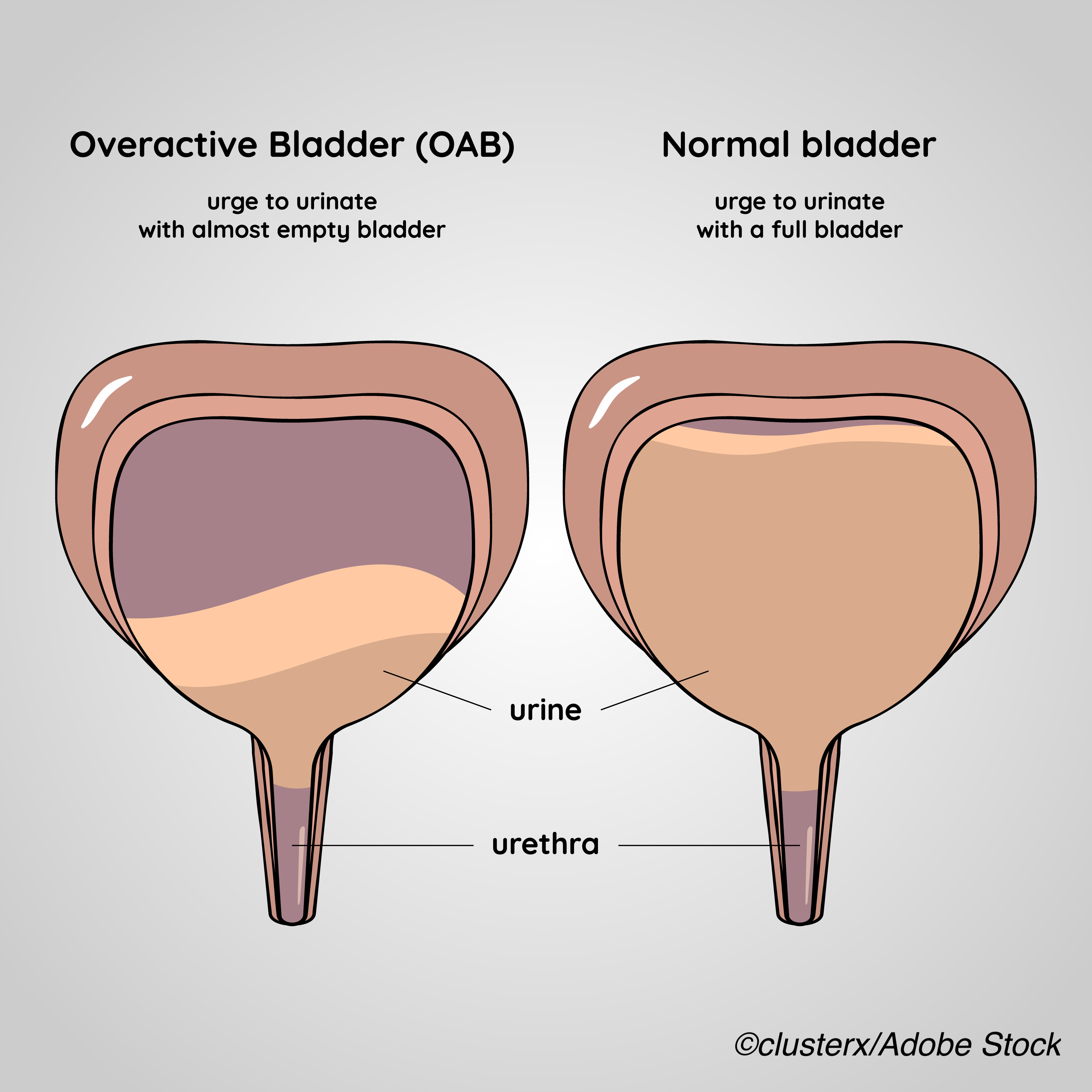 tips-to-calm-an-overactive-bladder-at-night-oab-causes