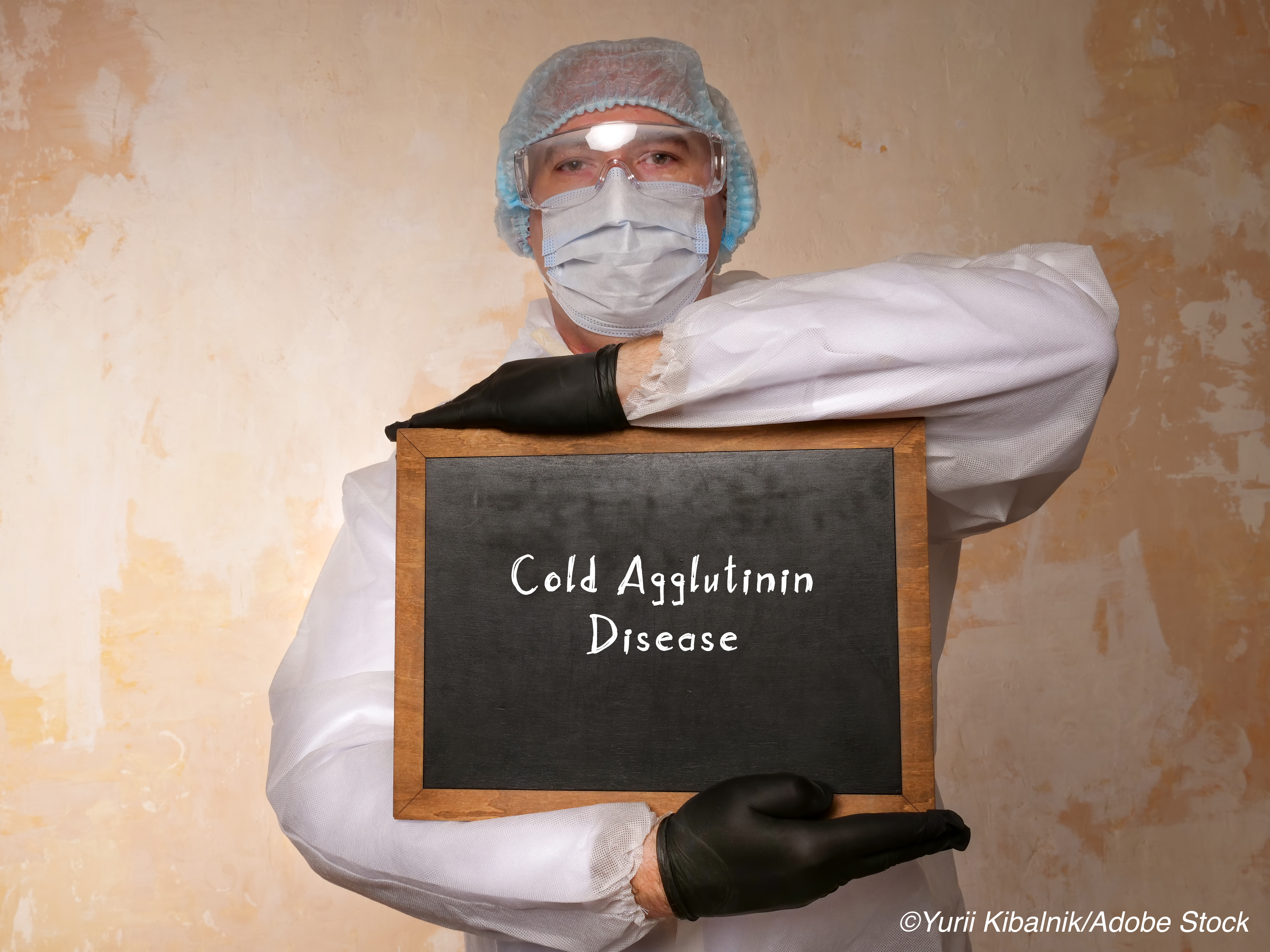 Novel Antibody Shows Benefit in Cold Agglutinin Disease
