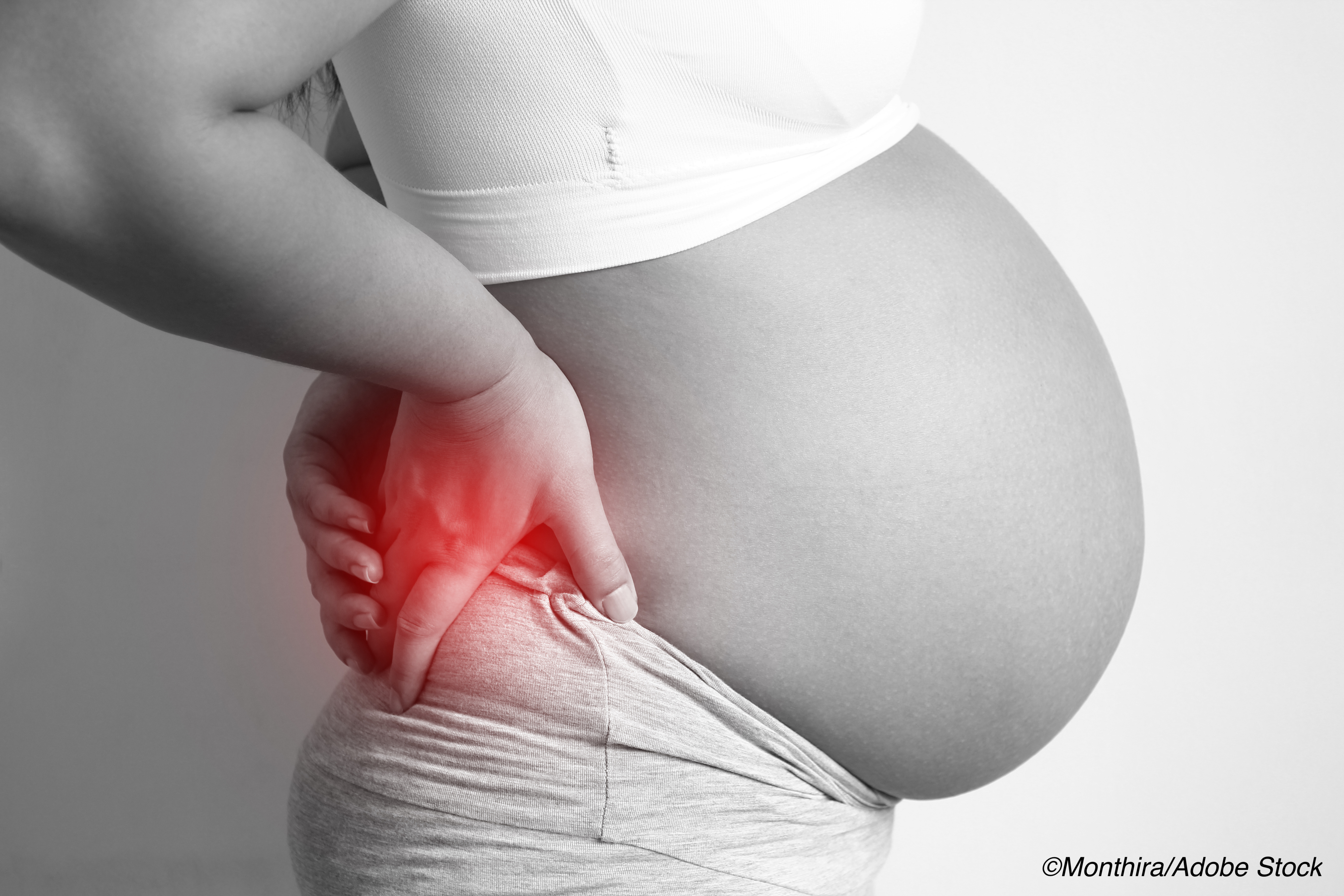 Kidney Stones—A Consequence of Pregnancy?
