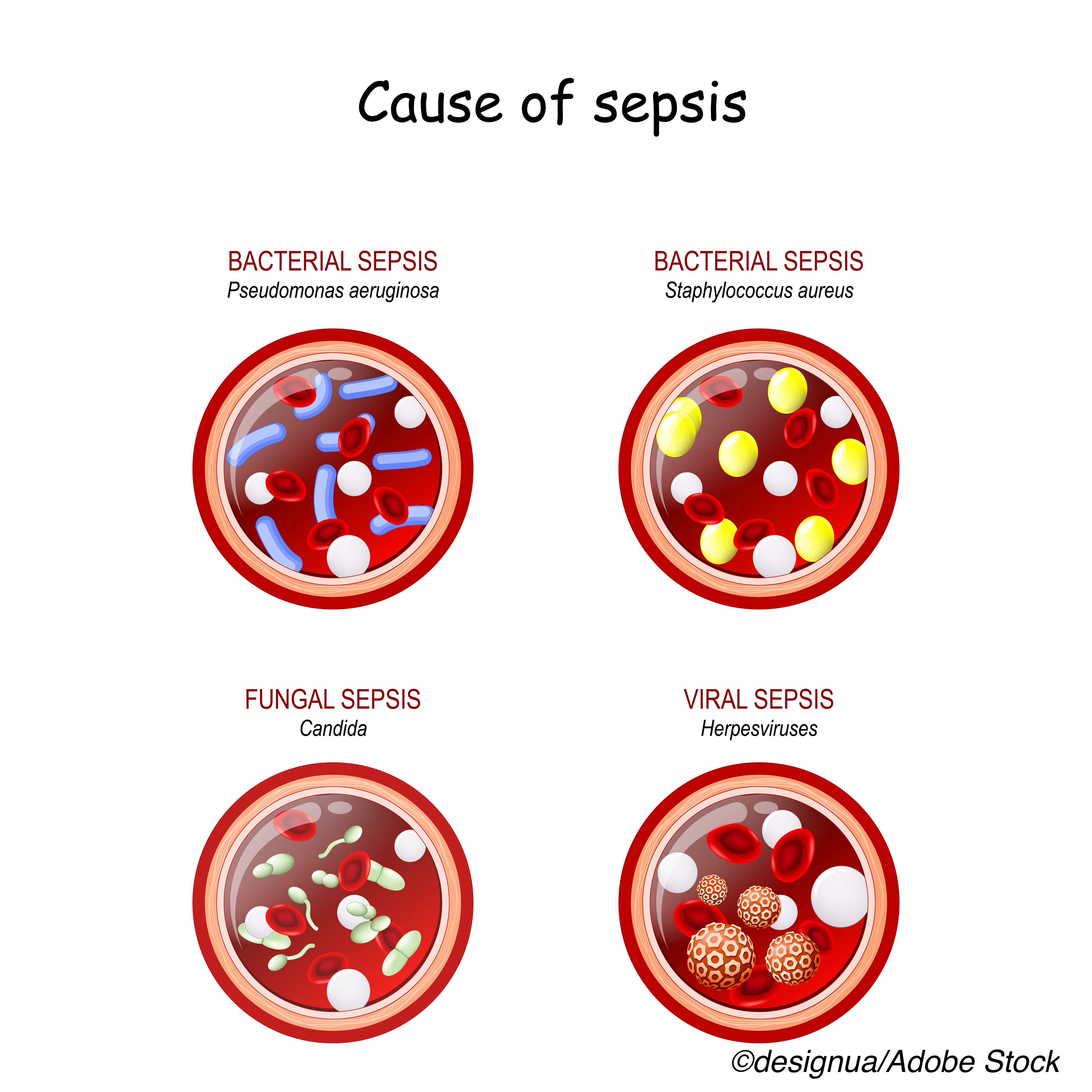 SEP-1 Failed to Reduce Sepsis Mortality in Real-World Study