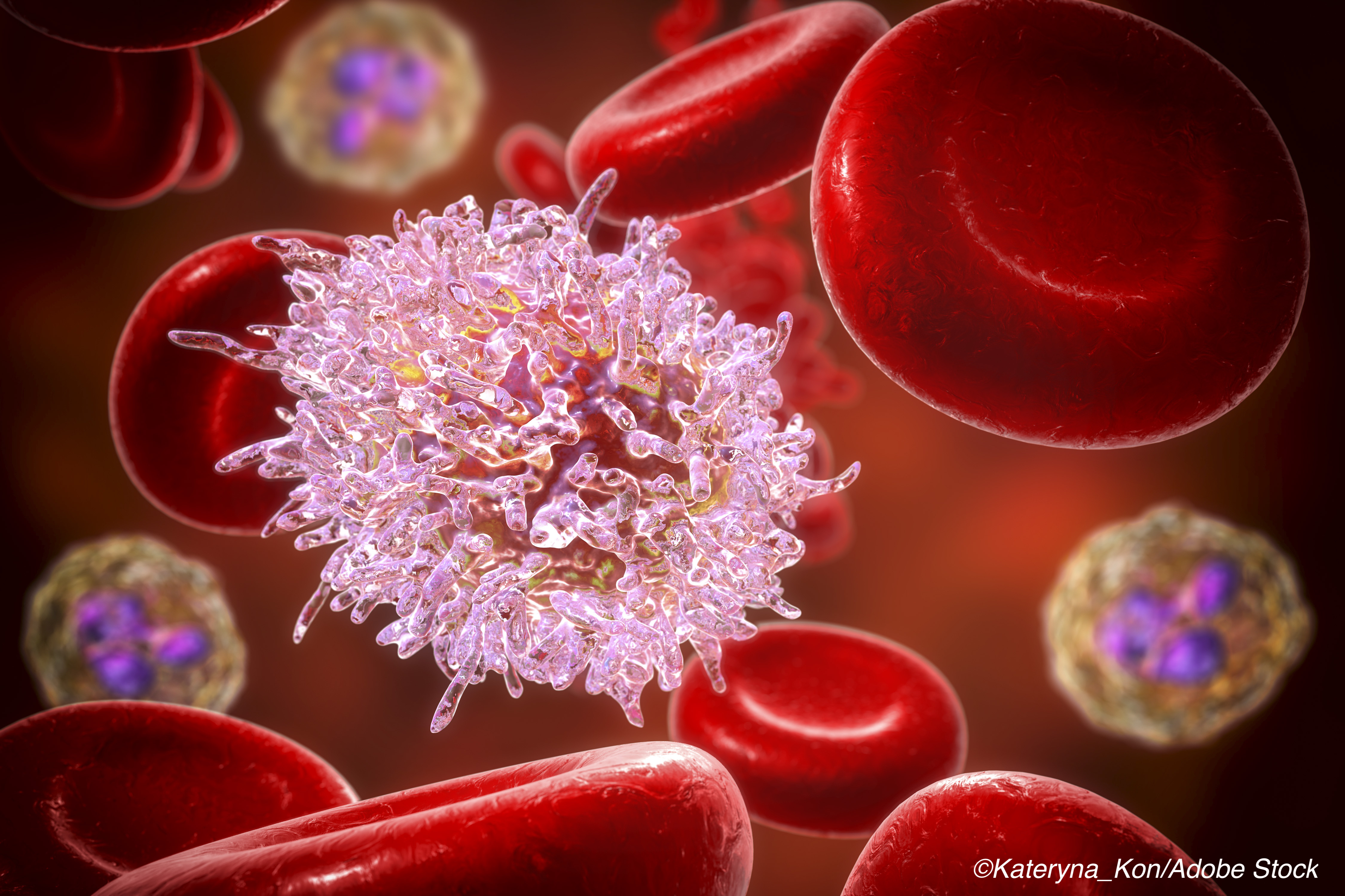 Chemo-Free Regimen Demonstrates Efficacy in Hairy Cell Leukemia
