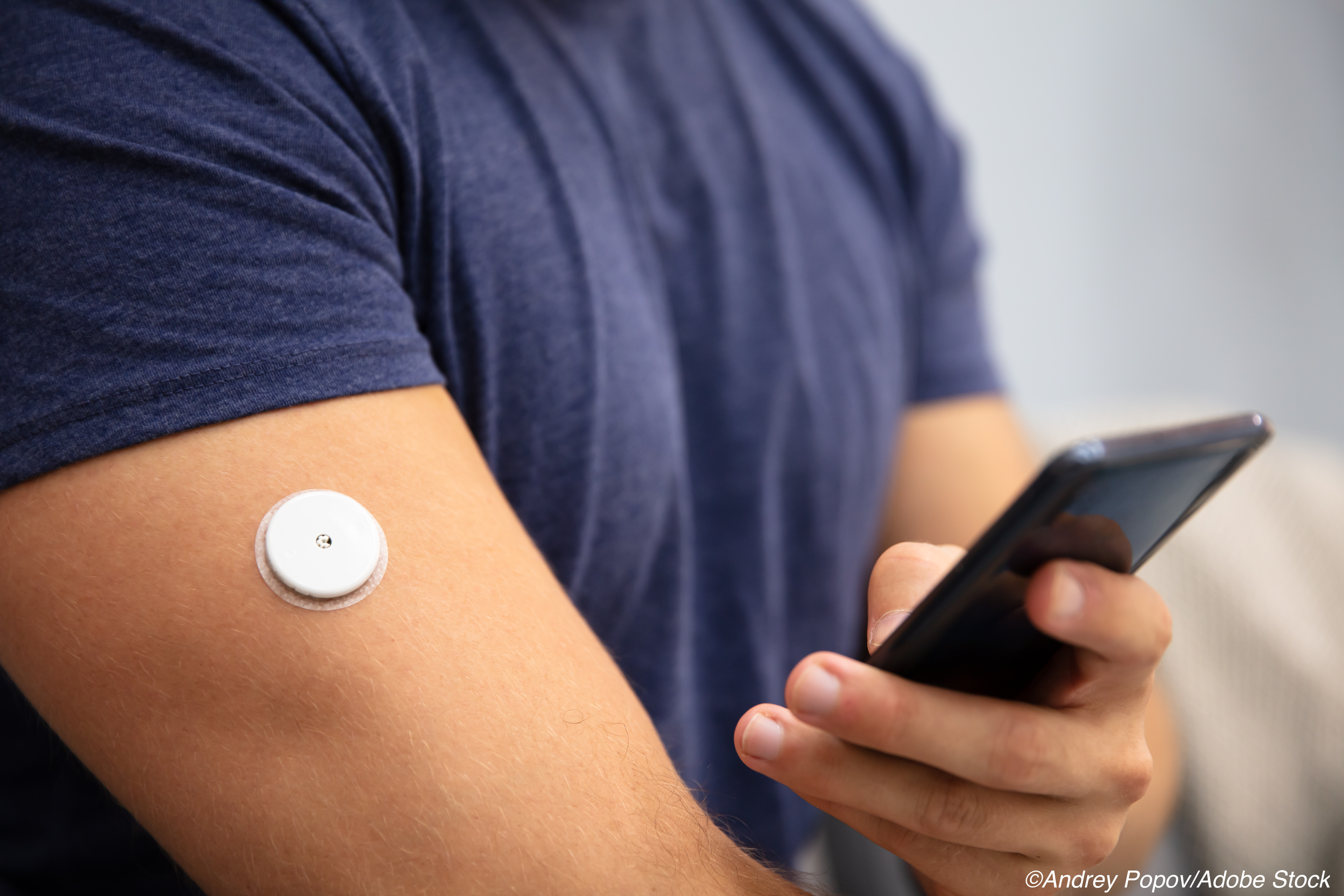 Real-time Continuous Glucose Monitoring Bests Intermittently Scanned in T1D Patients