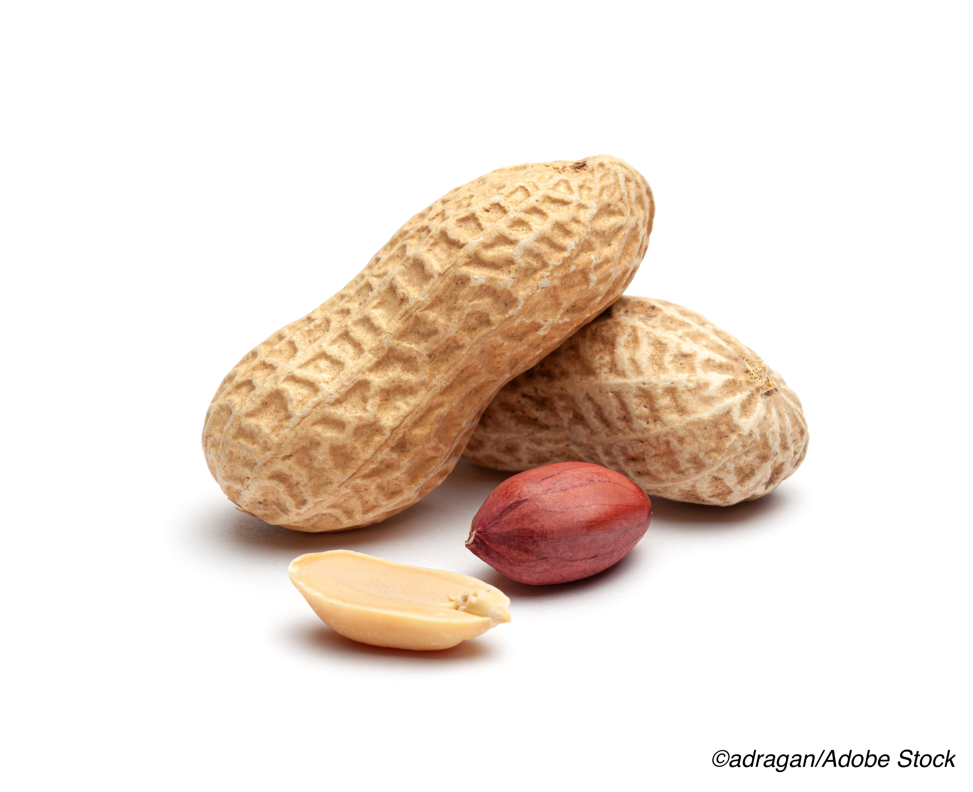 EAACI: 2 Years Out, Peanut Immunotherapy Is a Win