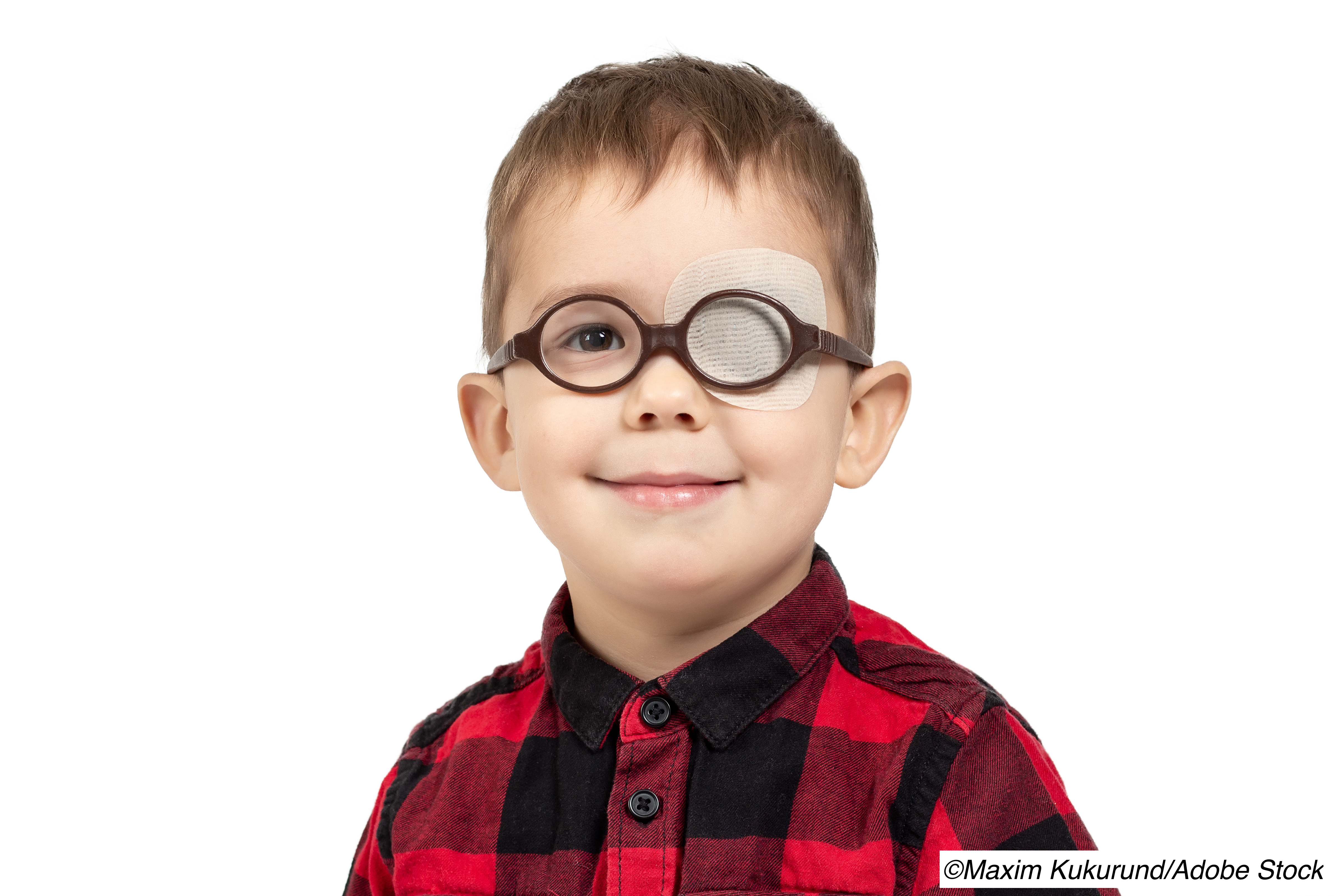 Amblyopia: Does Adding Atropine to Patching Improve Visual Outcomes?
