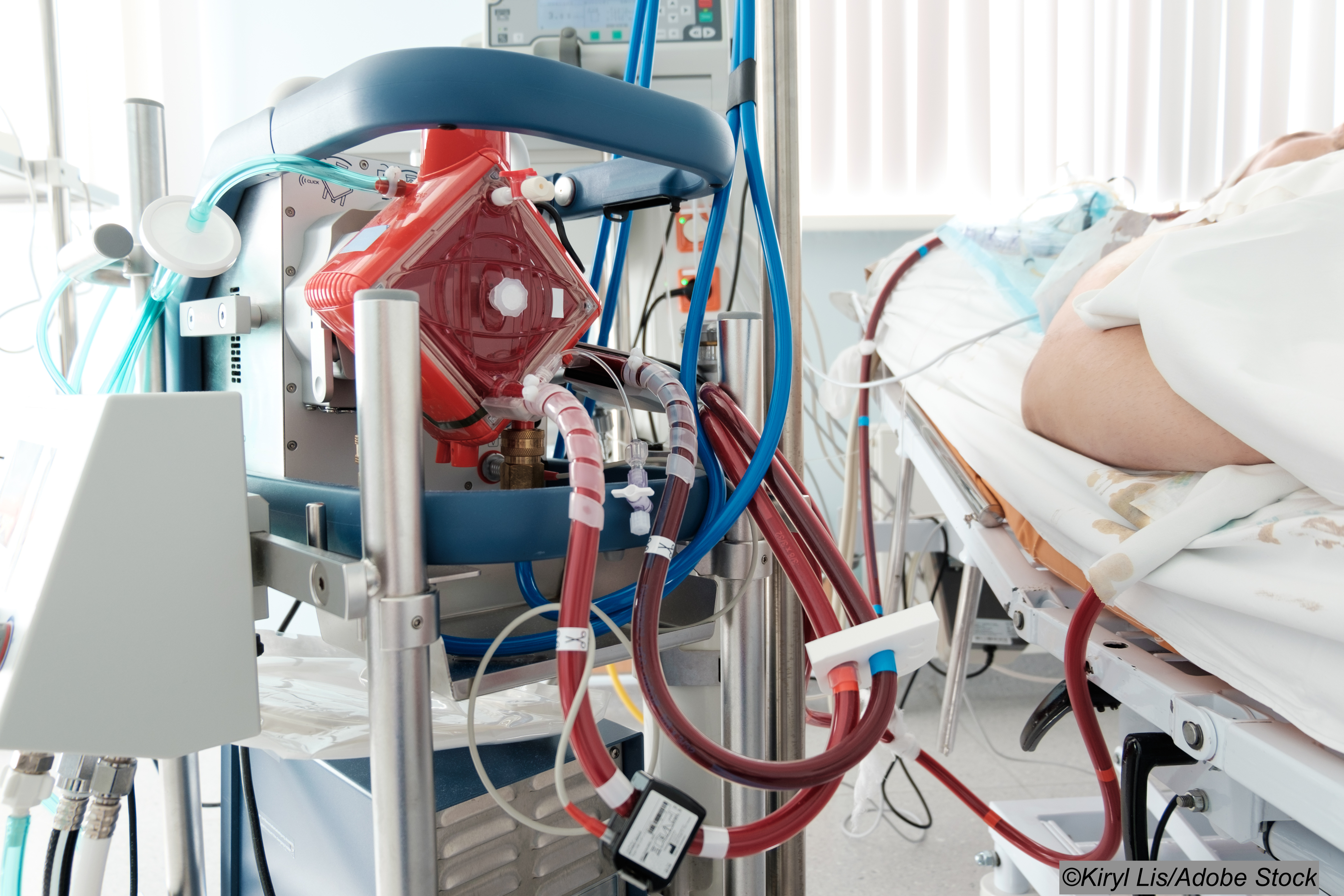 Covid-19: With ECMO, Experience Matters