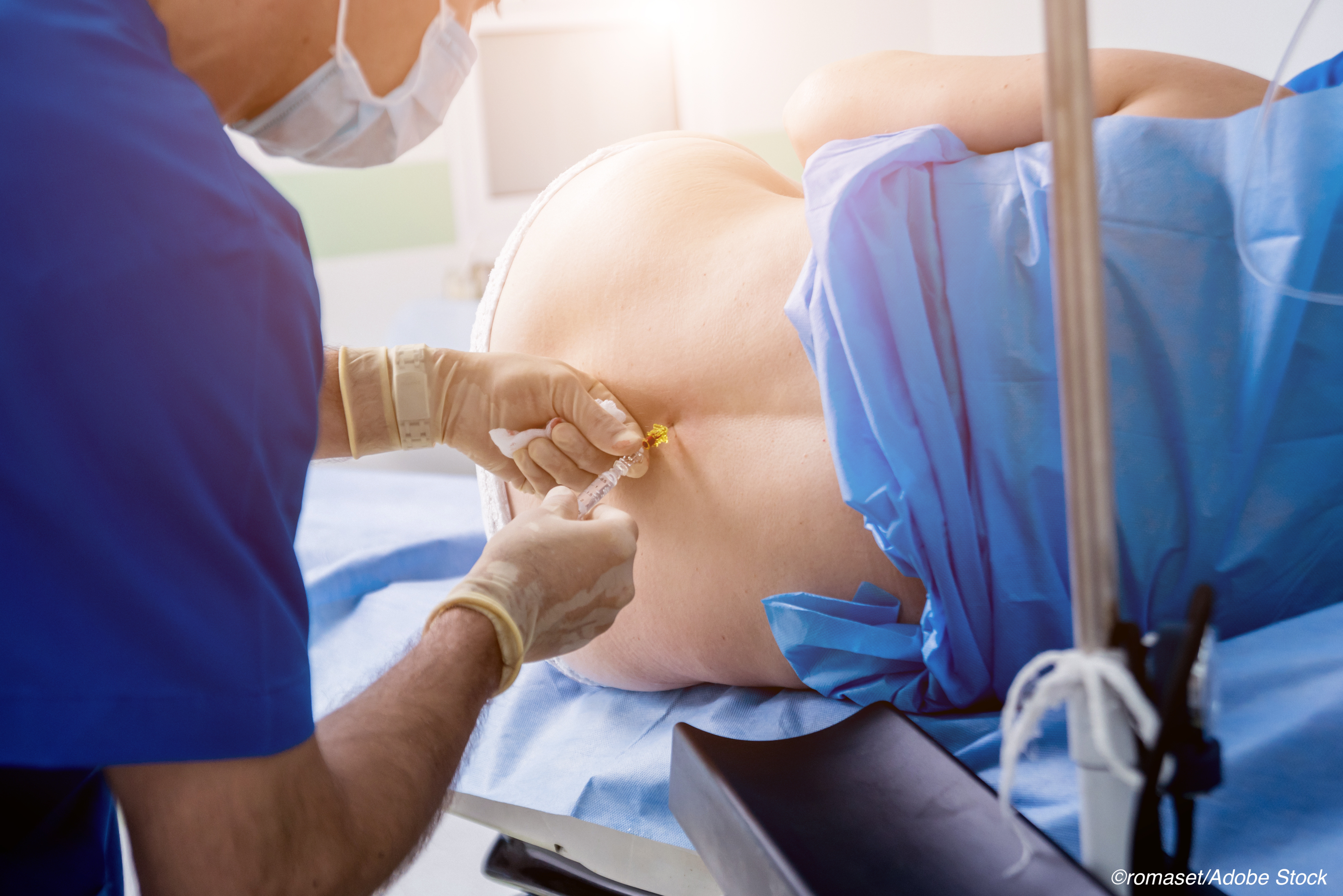 Epidural Use During Delivery Doesn’t Impact Offspring Neurodevelopment, Study Finds