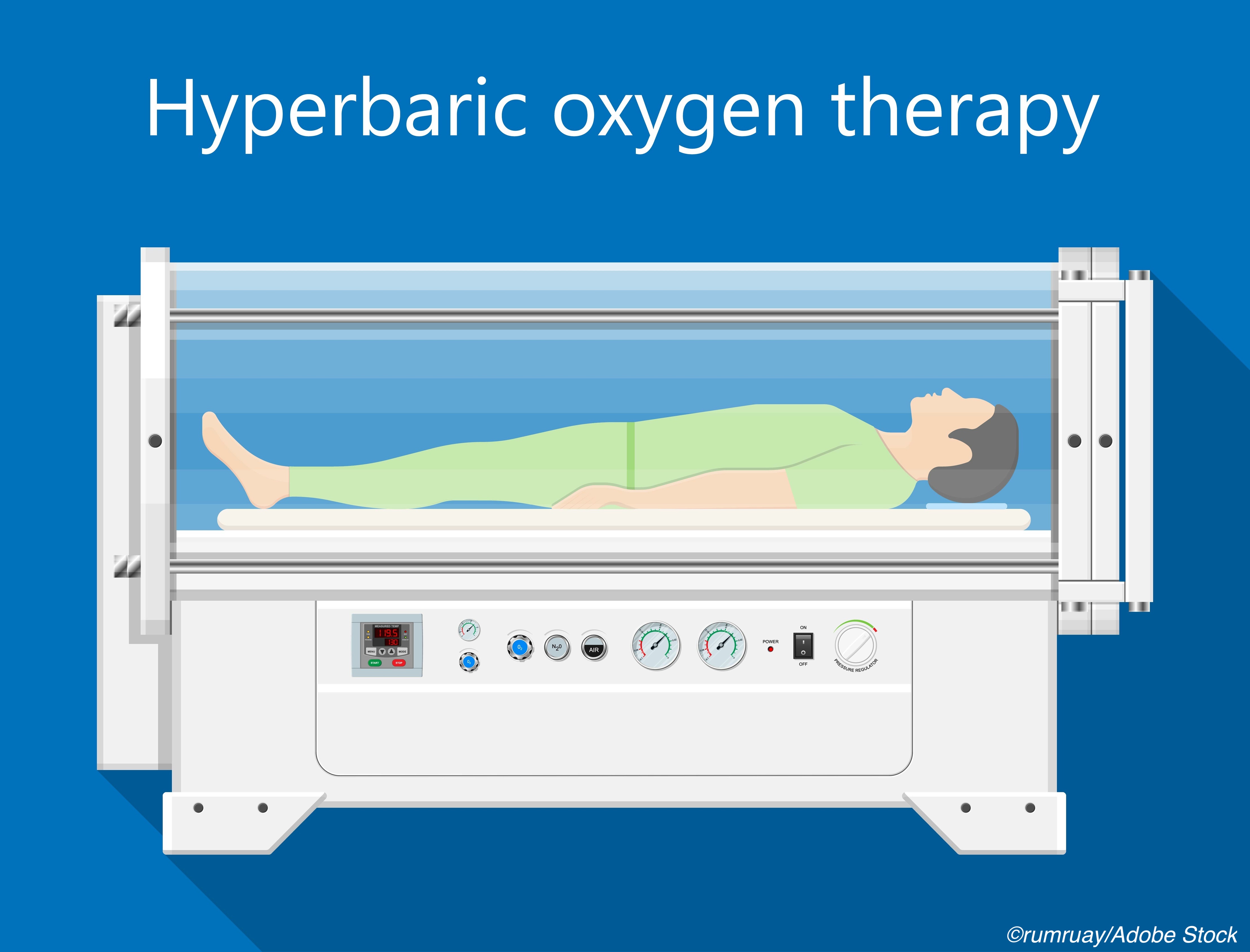 Sudden Sensorineural Hearing Loss: Can Hyperbaric Oxygen Tx Make a Difference?