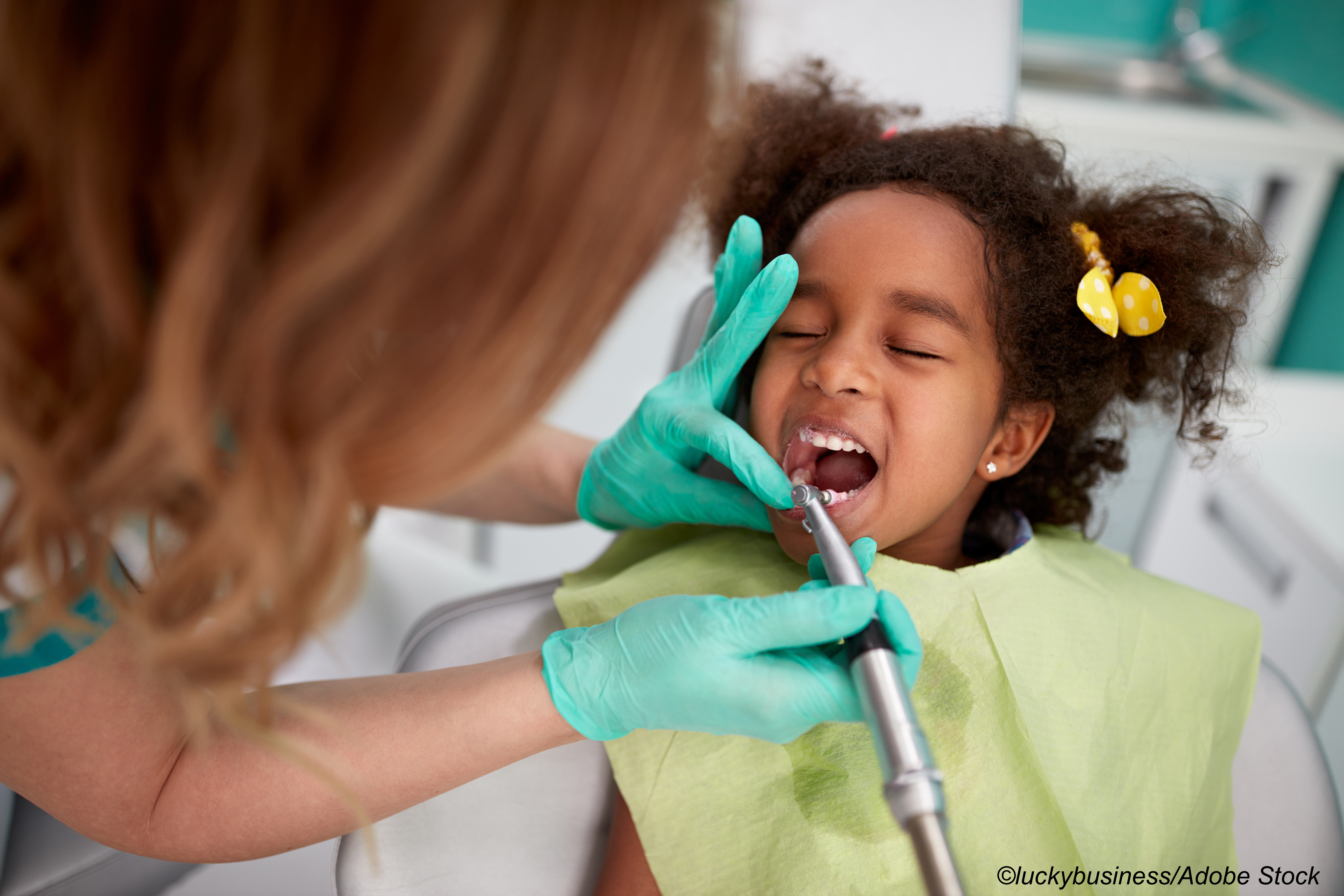 USPSTF Smiles on Fluoride Treatment for Young Children
