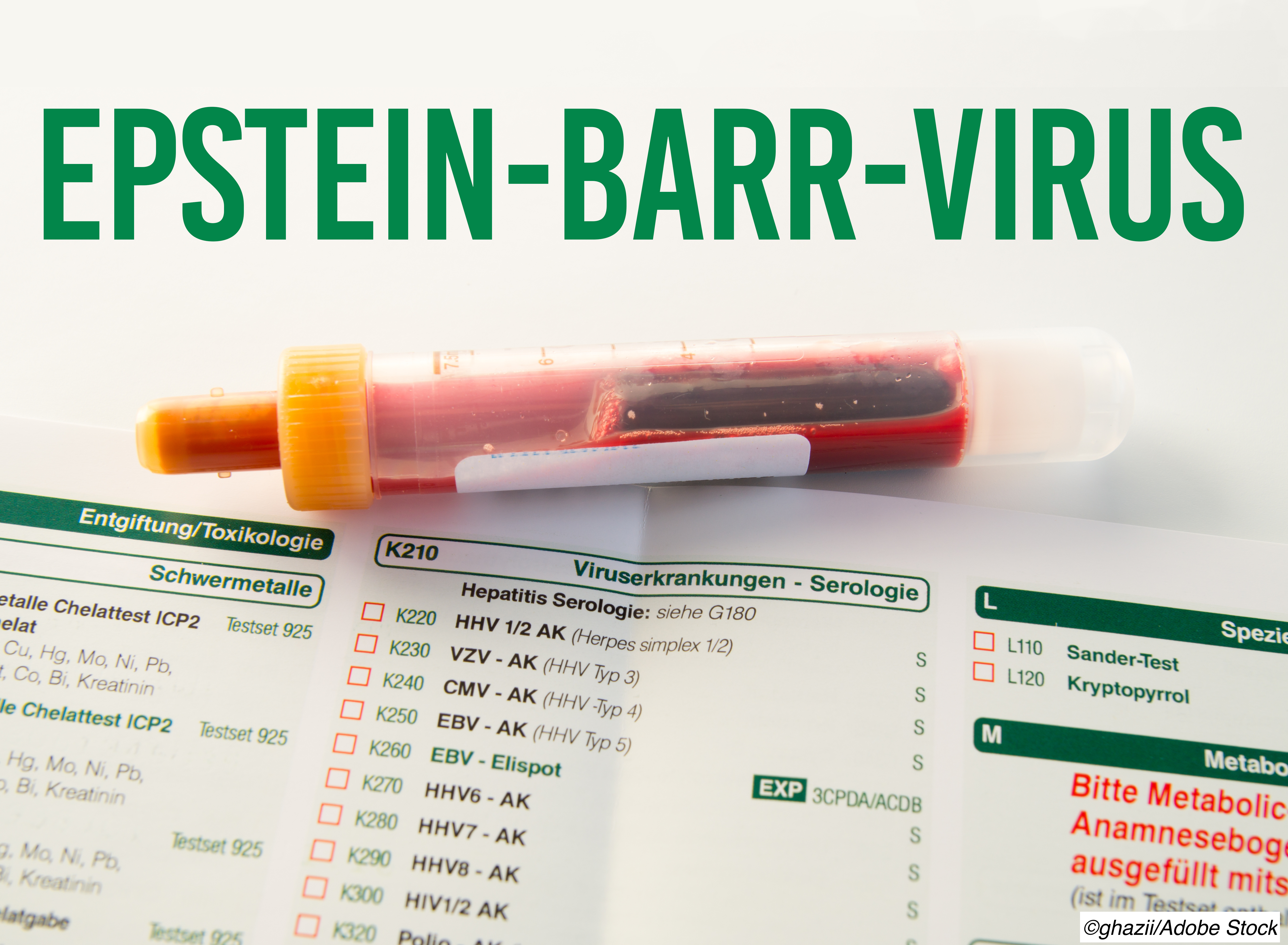 More Evidence Points to Epstein-Barr Virus as MS Trigger