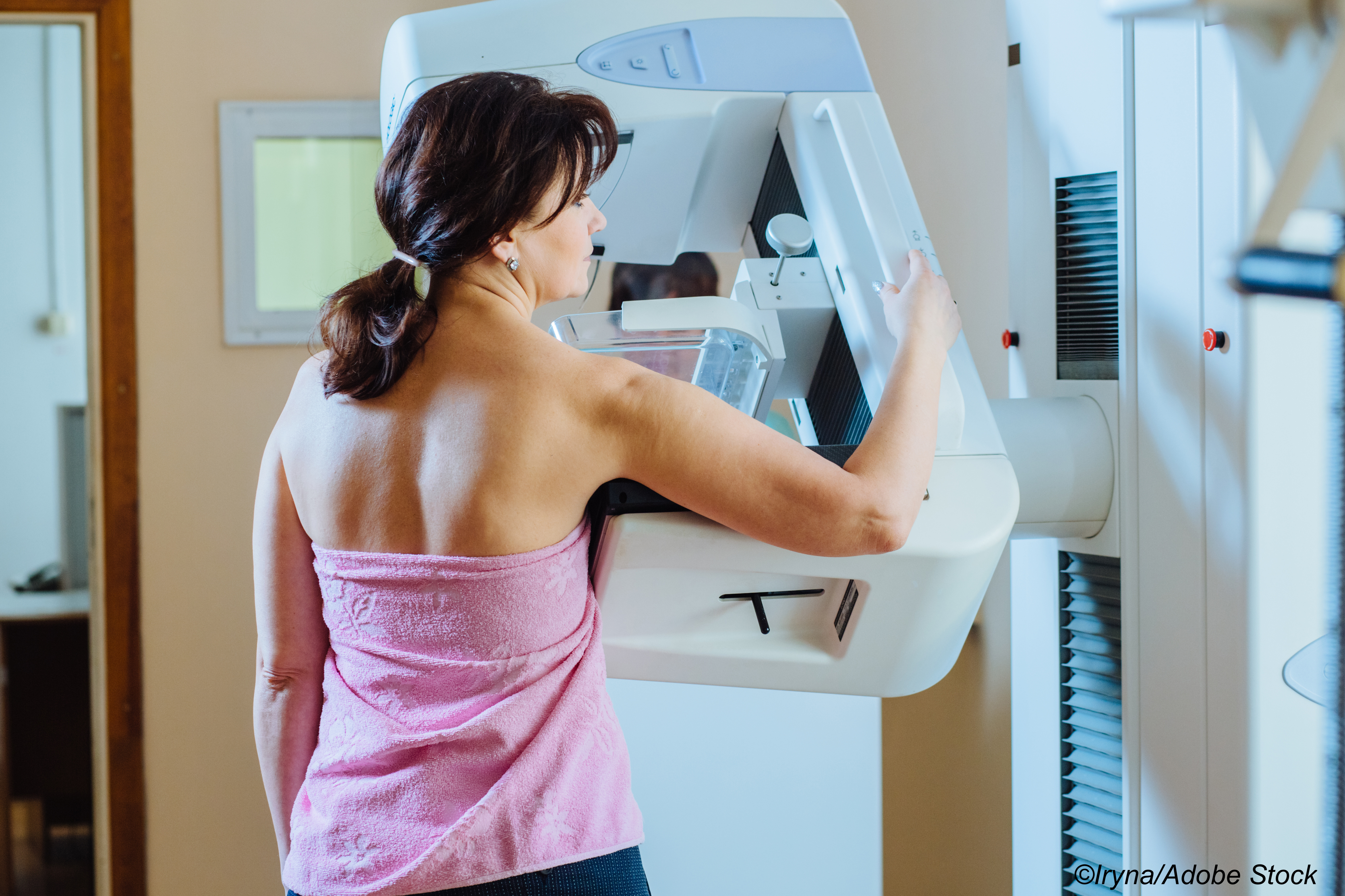 Most State-Level Plans Fail to Align with Breast Cancer Screening Recs